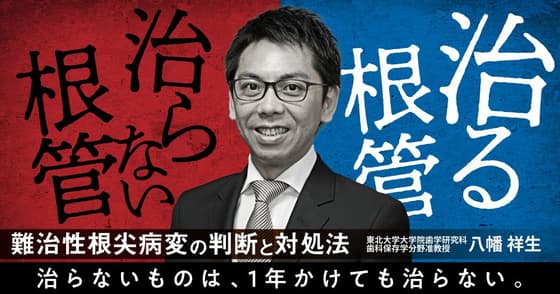 治る根管・治らない根管