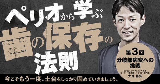 ペリオから学ぶ歯の保存の法則【第3回】