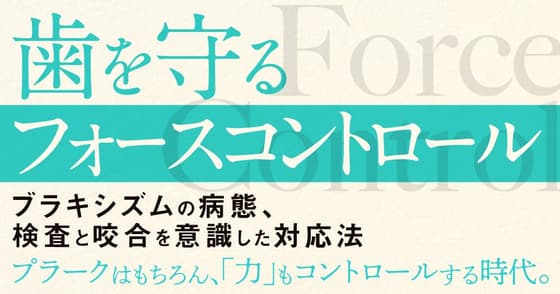 歯を守る「フォースコントロール」