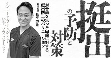 「挺出」の予防と対策