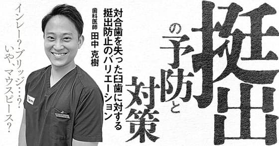 「挺出」の予防と対策