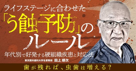 ライフステージに合わせた「う蝕予防」のルール