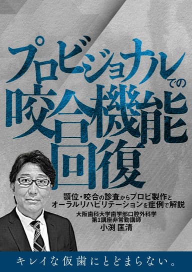 ランキング13位のプロビジョナルでの咬合機能回復