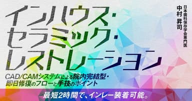 インハウス・セラミック・レストレーション