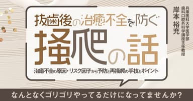 抜歯後の治癒不全を防ぐ「掻爬」の話