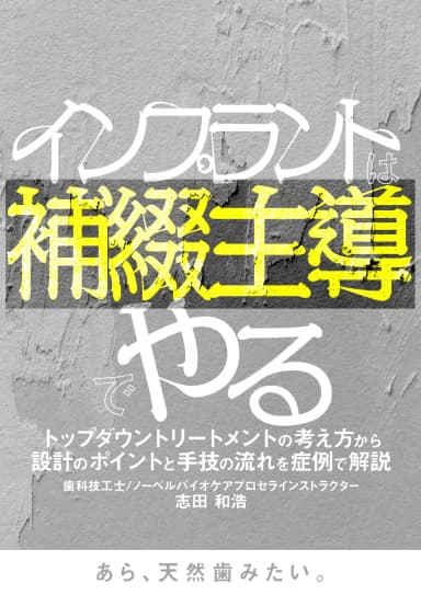 ランキング13位のインプラントは補綴主導でやる