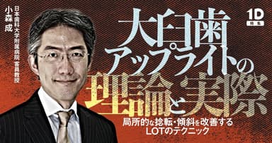 大臼歯アップライトの理論と実際