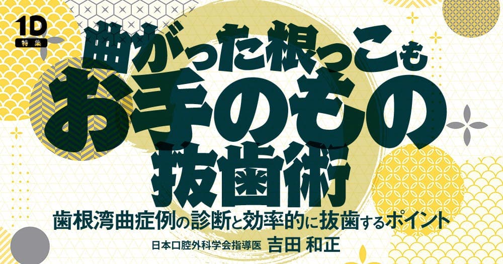 曲がった根っこもお手のもの抜歯術