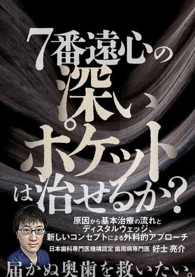 ランキング2位の7番遠心の深いポケットは治せるか？