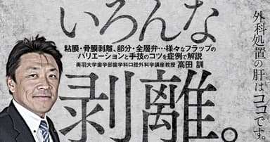 いろんな剥離。