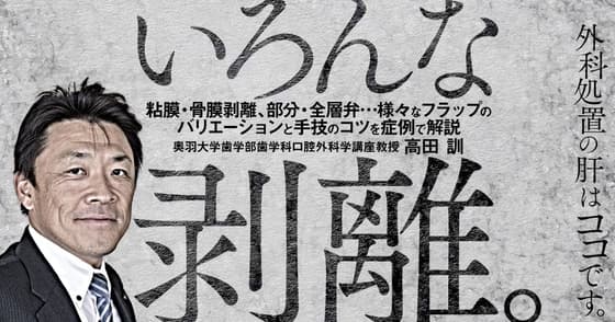 いろんな剥離。