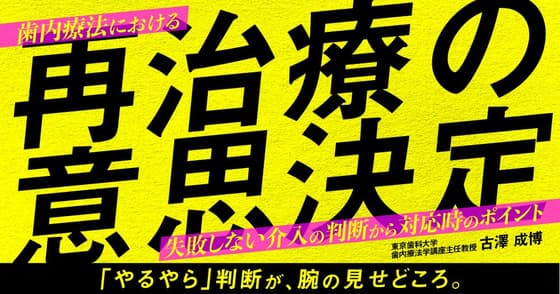 歯内療法における再治療の意思決定