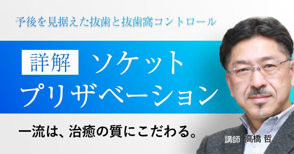 詳解「ソケットプリザベーション」