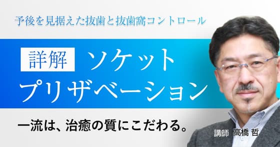 詳解「ソケットプリザベーション」