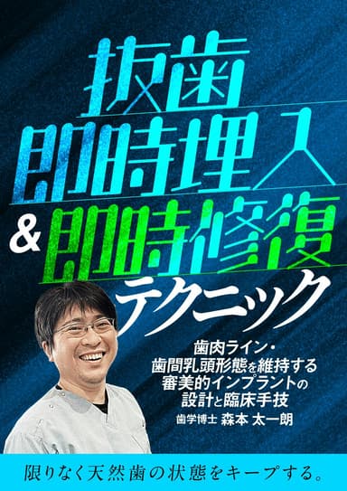 ランキング8位の抜歯即時埋入＆即時修復テクニック