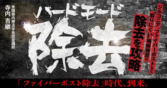 ハードモード除去