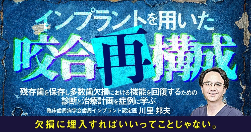 インプラントを用いた咬合再構成 - 残存歯を保存し多数歯欠損における機能を回復するための診断と治療計画を症例に学ぶ