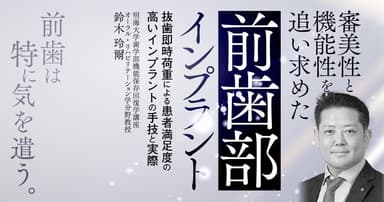 審美性と機能性を追い求めた前歯部インプラント
