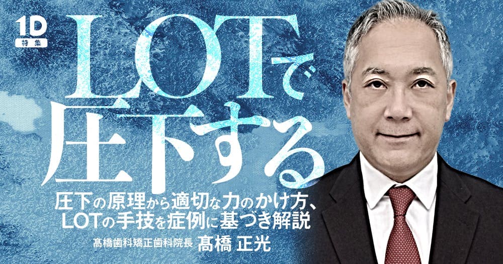 LOTで圧下する
