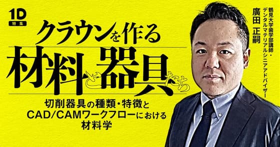 クラウンを作る「材料と器具」たち
