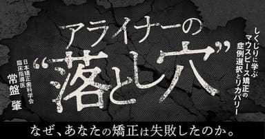 アライナーの"落とし穴"