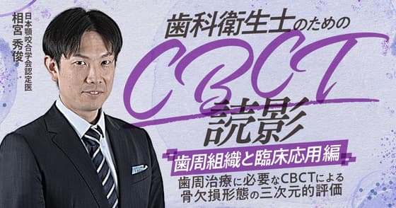 歯科衛生士のためのCBCT読影「歯周組織と臨床応用」編