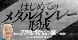 はじめての「メタルインレー形成」