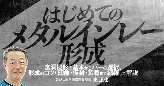 はじめての「メタルインレー形成」