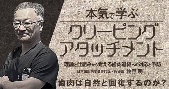 本気で学ぶ「クリーピングアタッチメント」