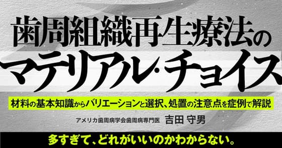歯周組織再生療法のマテリアル・チョイス