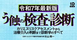 【令和7年最新版】う蝕の検査・診断
