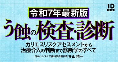 【令和7年最新版】う蝕の検査・診断