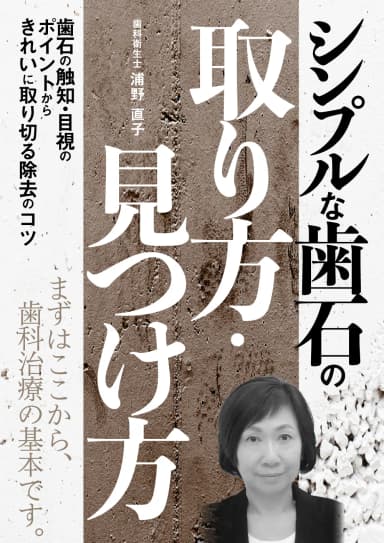 ランキング13位のシンプルな歯石の取り方・見つけ方