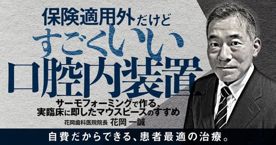 保険適用外だけどすごくいい口腔内装置