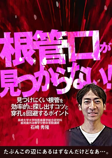 ランキング11位の根管口が見つからない！
