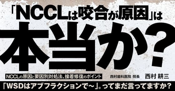 「NCCLは咬合が原因」は本当か？
