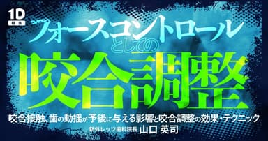 フォースコントロールとしての咬合調整