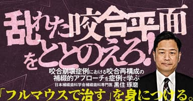 乱れた咬合平面をととのえろ！