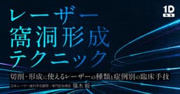 レーザー窩洞形成テクニック