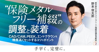 ”保険メタルフリー補綴”の調整と装着