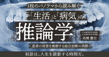 1枚のパノラマから読み解く「生活」と「病気」の推論学