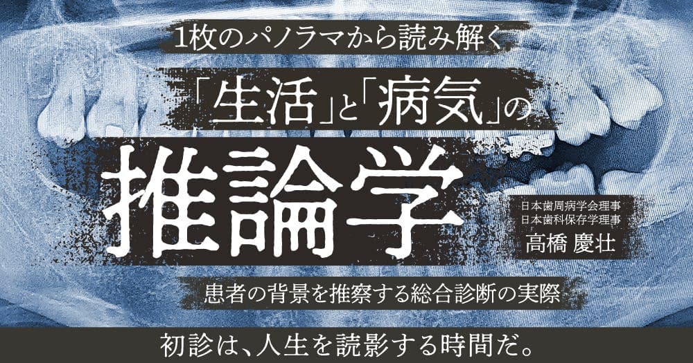 1枚のパノラマから読み解く「生活」と「病気」の推論学