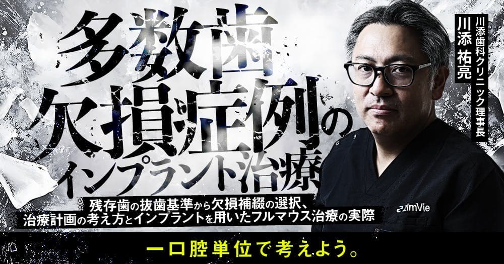 多数歯欠損症例のインプラント治療 - 残存歯の抜歯基準から欠損補綴の選択、治療計画の考え方とインプラントを用いたフルマウス治療の実際