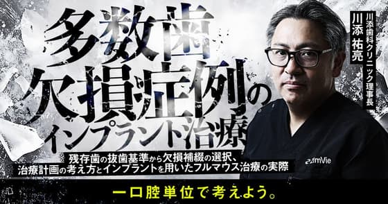 多数歯欠損症例のインプラント治療