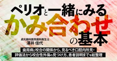 ペリオと一緒にみる「かみ合わせ」の基本