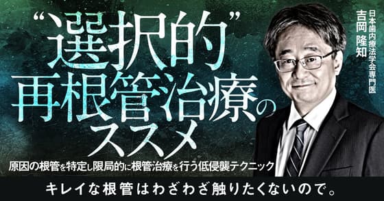 ”選択的”再根管治療のススメ