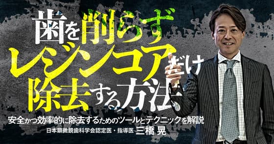 歯を削らずレジンコアだけ除去する方法