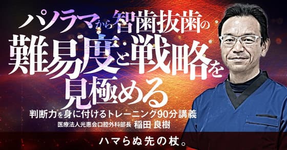 パノラマから智歯抜歯の難易度と戦略を見極める