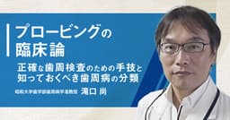 プロービングの臨床論