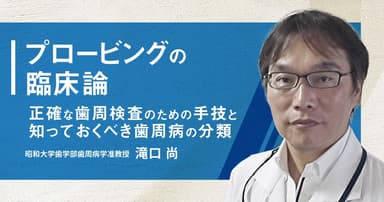プロービングの臨床論
